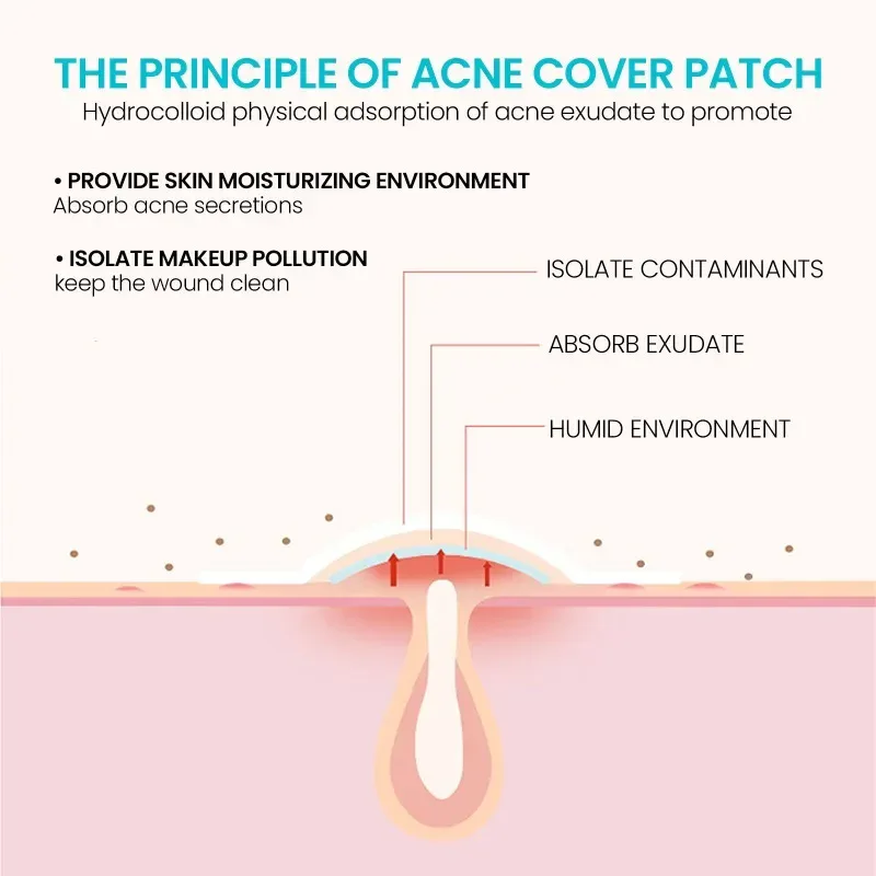 Acne Pimple Patch Invisible